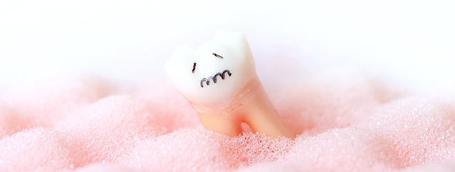 歯槽膿漏と口臭の原因・検査について